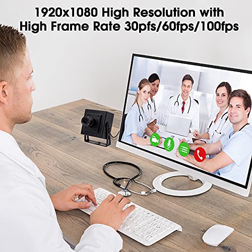 SVPRO USB Webcam 1080P HD Camera 30fps/60fps/100fps High – Close-up Detail