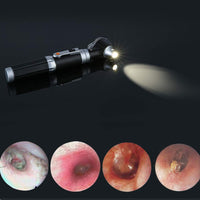 Mini Ear Otoscope, Bysameyee Magnification Diagnostic Ear Scope with LED Direct Illumination Light, Ear Healthy Tool for Doctors Nurses Adults Kids Baby Elder Pets Animals