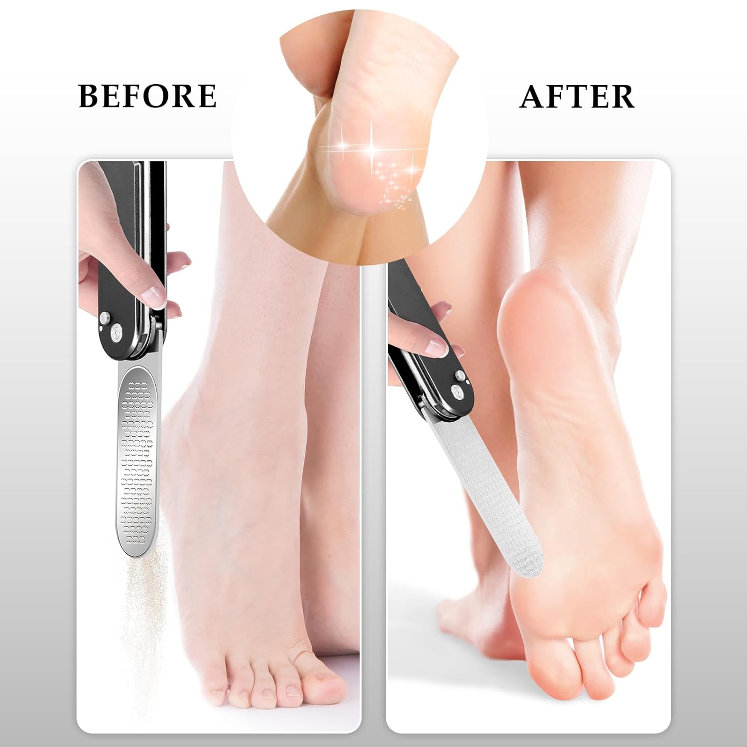 Callus Remover for Feet, Portable Foot File Heel Scraper Foldable Feet Scrubber Pedicure Tools Foot Exfoliator Dead Skin Remover