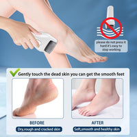 Foot Callus Remover Electric Callus Remover for Feet,Electric Foot Scrubber Dead Skin Remover,Professional Pedi Feet Care Perfect with 3 Rollers&2 Speed for Dead,Hard Cracked Dry Skin Ideal Gift(White