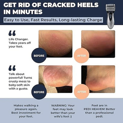 Electric Callus Remover: Own Harmony CR900 Rechargeable – Side View