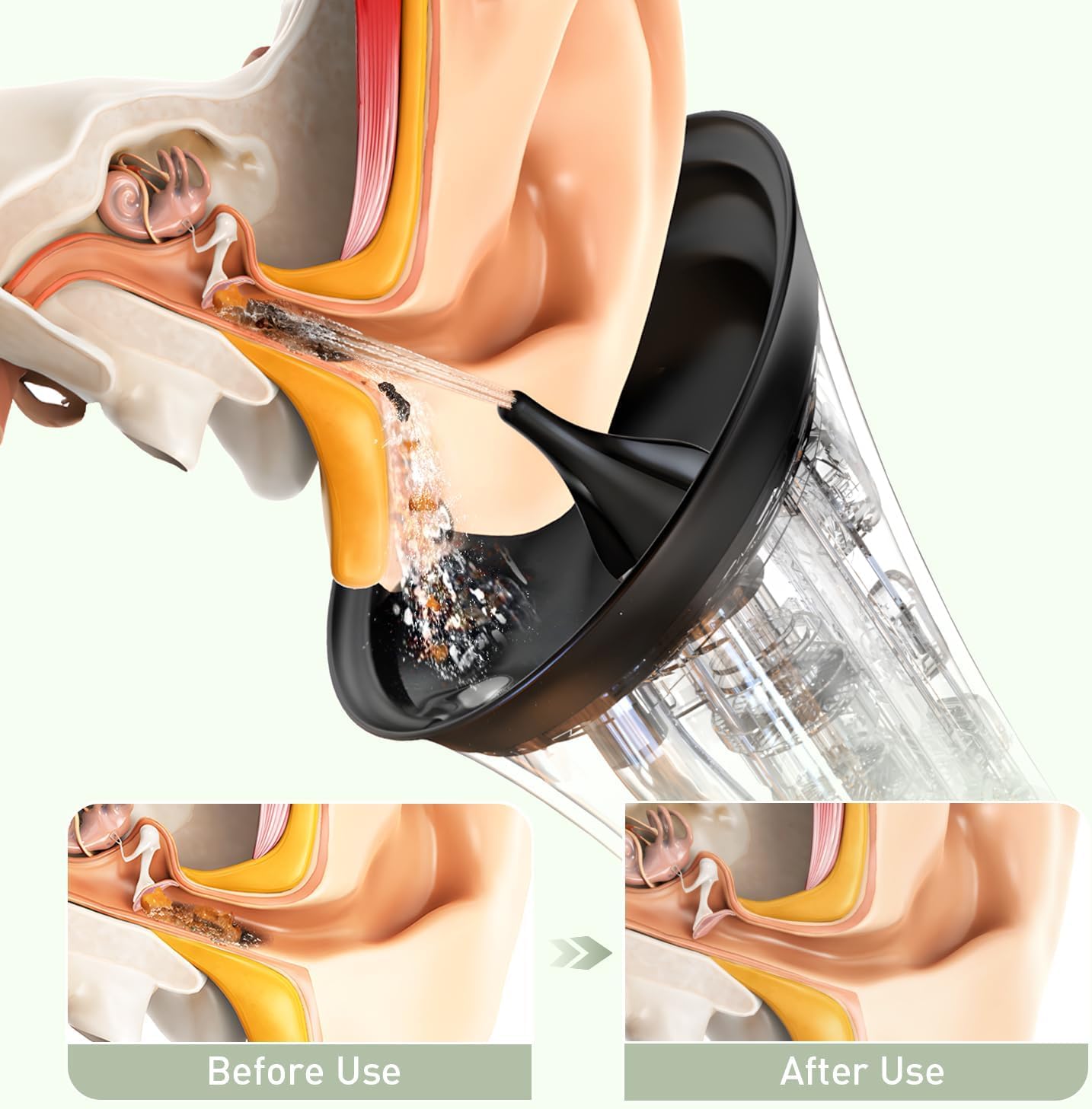 Ear Wax Removal: Electric Ear Cleaner with IPX7 – Side View