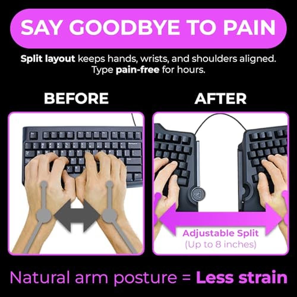 Cloud Nine: C989M Ergonomic Mechanical Keyboard – Close-up Detail