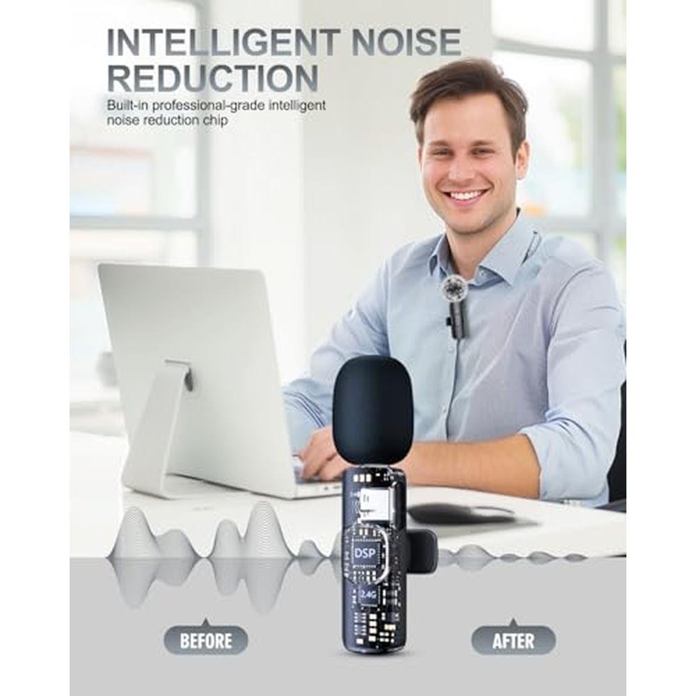 Microphone PQRQP: PQRQP 3 in 1 Professional Wireless – Close-up Detail