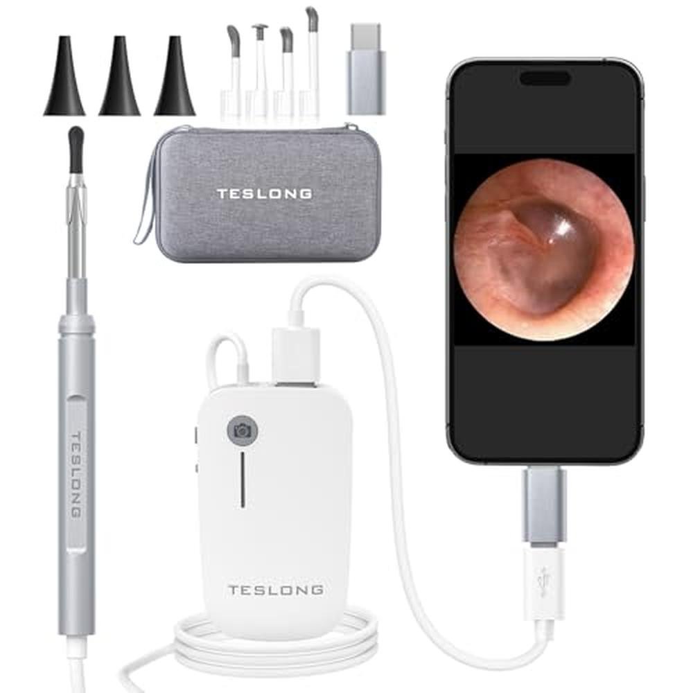 Ear Otoscope: Teslong Digital Otoscope with Light 1080p HD – Front View