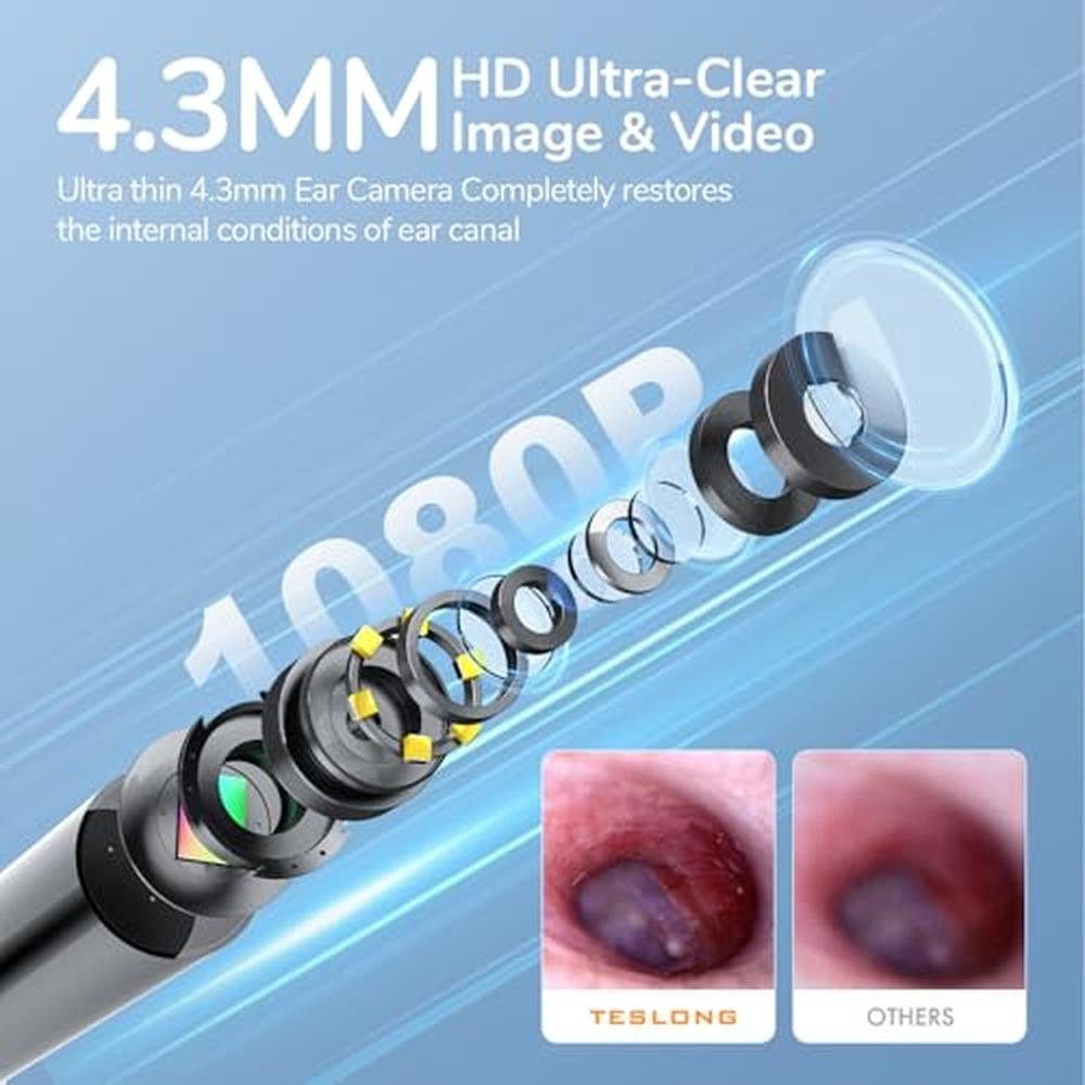 Ear Otoscope: Teslong Digital Otoscope with Light 1080p HD – Side View
