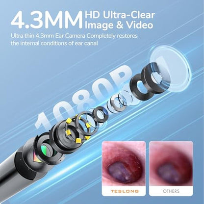 Ear Otoscope: Teslong Digital Otoscope with Light 1080p HD – Side View