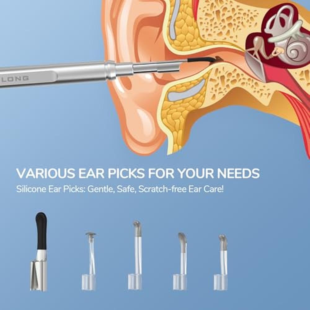 Ear Otoscope: Teslong Digital Otoscope with Light 1080p HD – Close-up Detail
