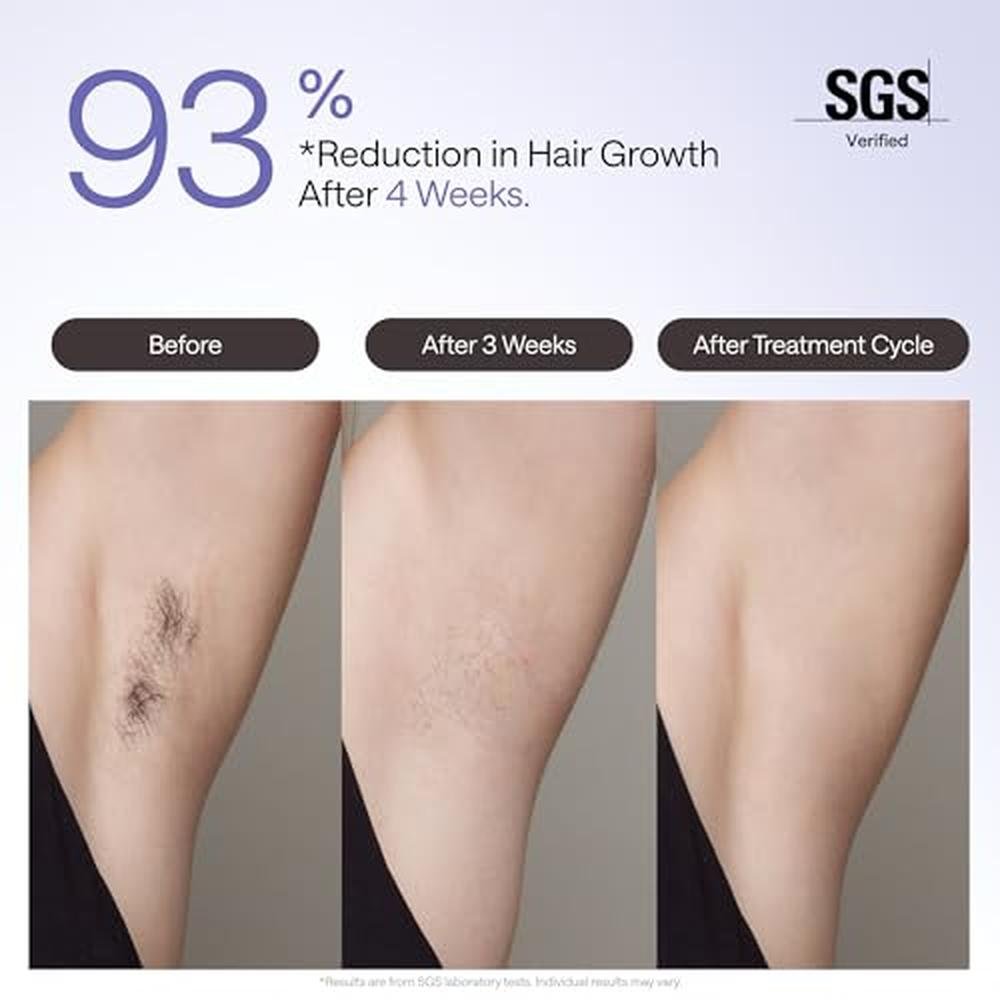 Ulike Laser Hair Removal Device Air 4 Ipl Gift for Women – Side View